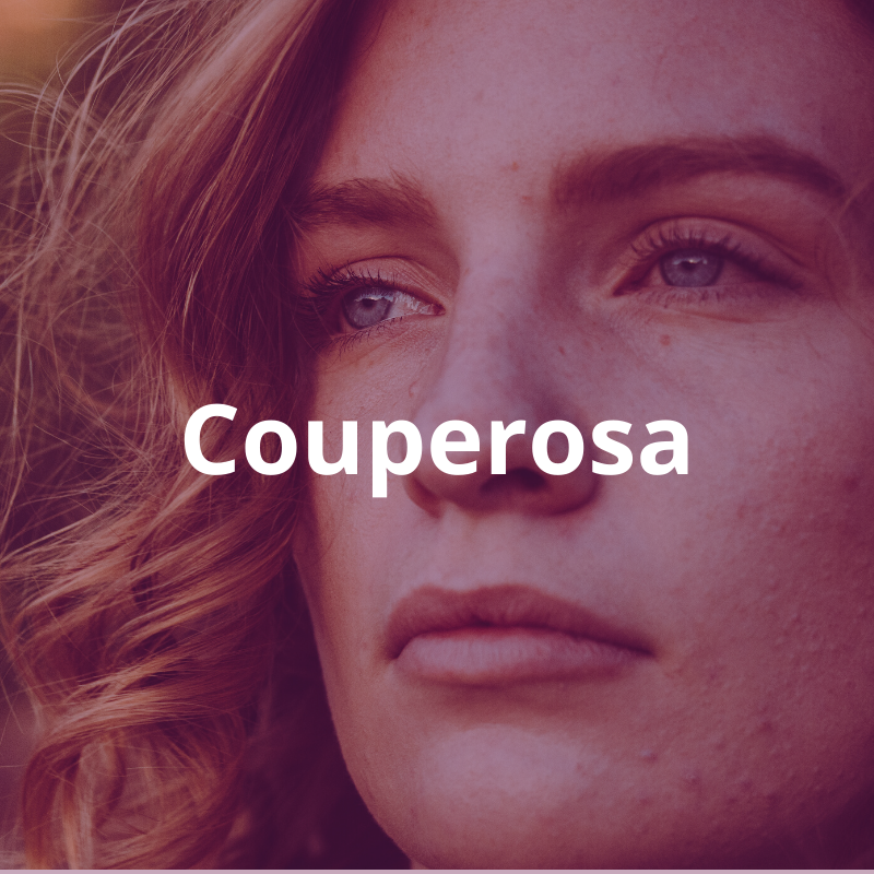 Tuoteryhmä: Couperosa